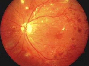 什么是视网膜屏幕？