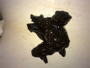 为什么拉的屎是黑绿色的