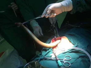 w人工杀黄鳝手法视频教程