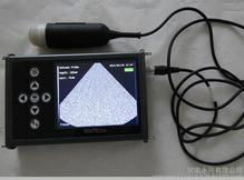 阴超检查什么项目