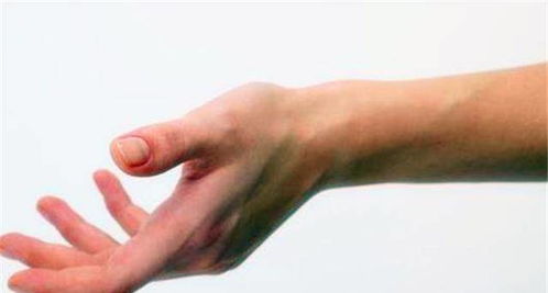 手为什么会麻木疼