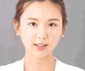 发际线多高算正常