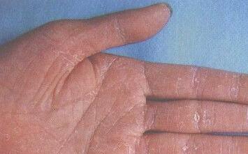 为什么手上会有手气？