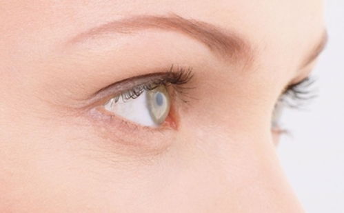 女人如何去鱼尾纹