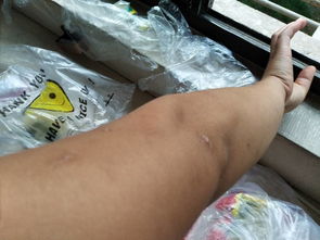 皮肤黑用什么洗脸会白