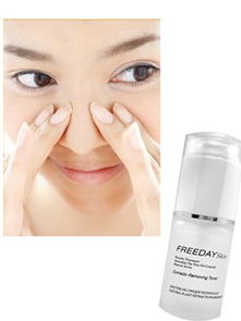 暗疮针怎么去黑头效果好