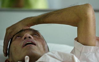 艾滋潜伏期有没有症状