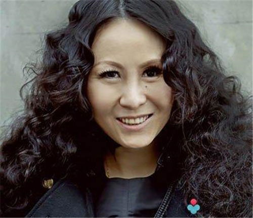 我是歌手中的罗琦眼睛怎么回事