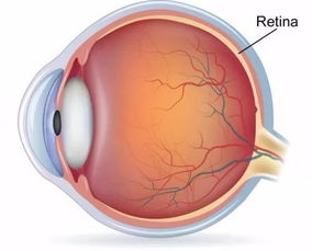 视网膜是什么？