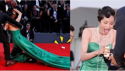 奚梦瑶在维密秀上摔了一跤，对她的事业可产生了影响？