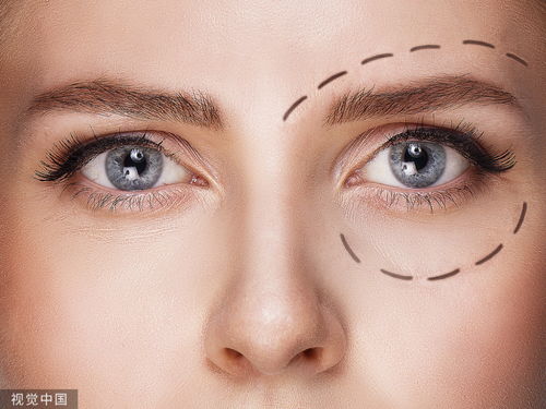 眼睛老是跳是怎么回事，两个眼睛一直跳是什么原因