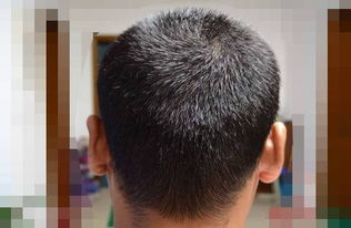 发际线是什么意思图片