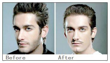 络腮胡子怎么去除???