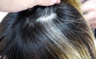 梦见自己头发白了好多