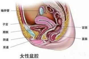 盆腔积液怎么治疗才能彻底
