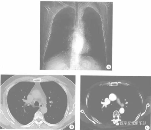 一般做一个CT多少钱
