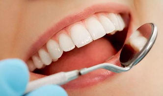 牙齿腐烂是什么原因造成的