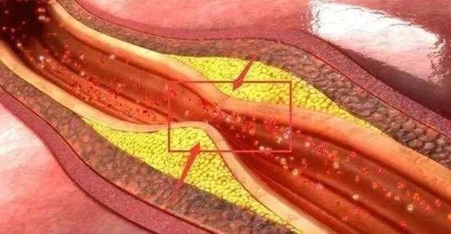 身上有白斑块是什么原因造成的