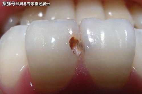 梦见掉牙齿是什么征兆女人