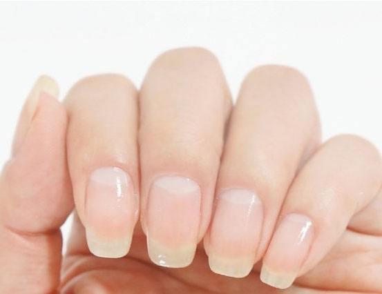 指甲上的月牙变小或消失是怎么回事