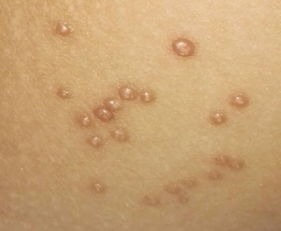 疮痍怎么读,庁疮