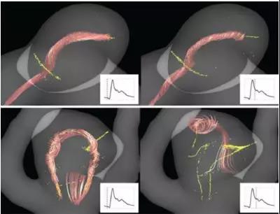 血流速度是多少