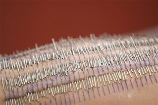 针针见血 句句到肉是什么意思