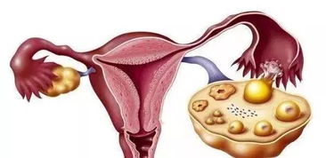 如何保养卵巢预防卵巢早衰