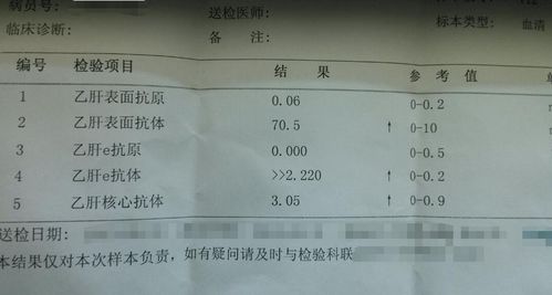 乙肝五项结果对照表是什么