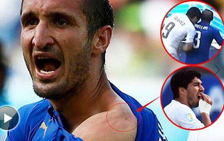 被苏亚雷斯咬过的人,苏亚雷斯咬人俄罗斯