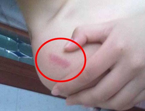 种草莓要避开哪些位置图片