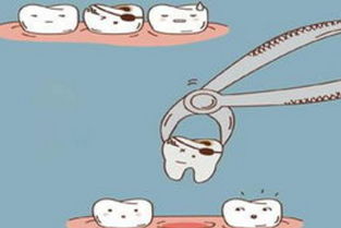 做梦拔牙是什么意思女生