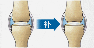 关节酸疼是怎么回事