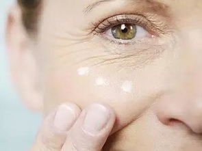 有鱼尾纹用什么眼霜好