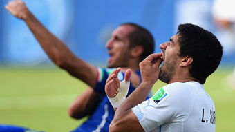 被苏亚雷斯咬过的人,苏亚雷斯咬人俄罗斯