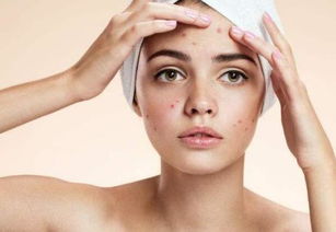 内分泌失调痘痘什么样子