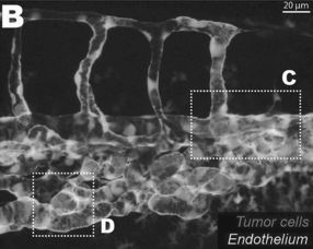 有少量血流信号是什么意思？