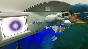 做激光近视眼手术价格