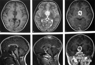 CT的中文意思是什么