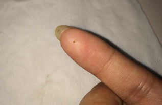 跳蚤怕什么东西,跳蚤怕什么东西或者味道