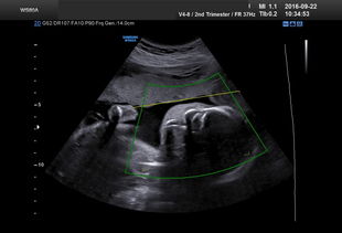 思维是什么意思简单的说