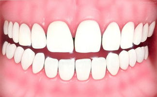 做梦梦见牙齿掉了好多颗