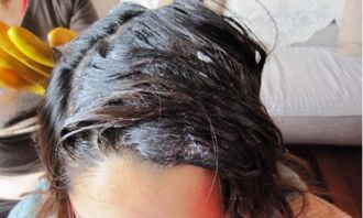 衣服上弄了染发剂用什么能洗掉