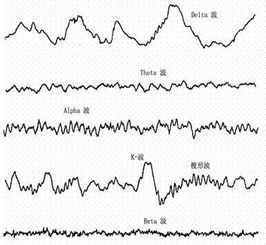 1赫兹 指的是1hz/秒，1hz/km？两种都可以写吗？